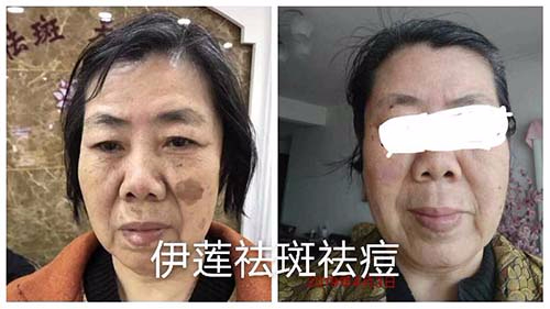 純中藥?kù)畎叽砑用苏猩? title=